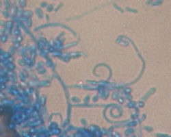 Arthroderma thuringiensis Abb. 3 d