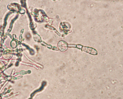 Epidermophyton floccosum Abb. 5