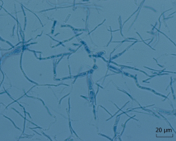 Nannizzia perplicata Abb. 3 b