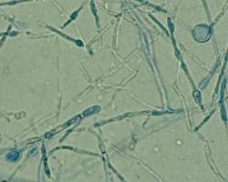 Arthroderma onychocola Abb. 3 c