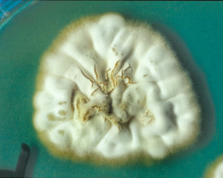 Epidermophyton floccosum Abb. 3