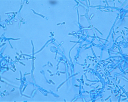 Trichophyton tonsurans Abb. 4 b