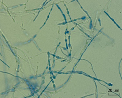 Trichophyton indotineae Abb. 4 c