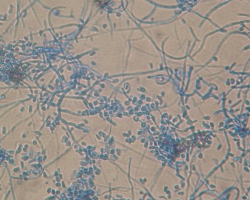 Arthroderma thuringiensis Abb. 3 a