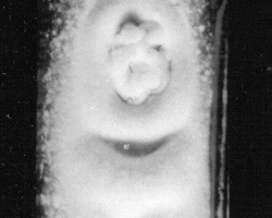 Trichophyton schoenleinii Abb. 1