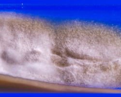 Trichophyton indotineae Abb. 2
