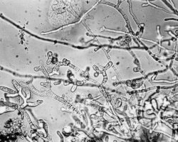 Trichophyton schoenleinii Abb. 4 a