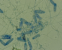 Nannizzia (N.) incurvata Abb. 3 a