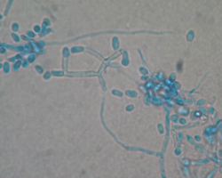 Arthroderma thuringiensis Abb. 3 b