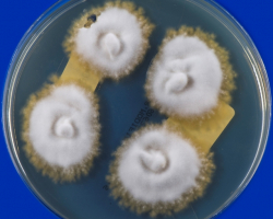 Trichophyton schoenleinii Abb. 3 a