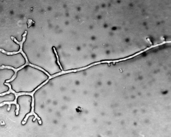 Trichophyton schoenleinii Abb. 4 b