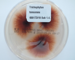 Trichophyton tonsurans Abb. 3