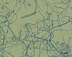 Trichophyton indotineae Abb. 4 d