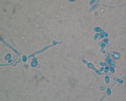 Arthroderma thuringiensis Abb. 3 c