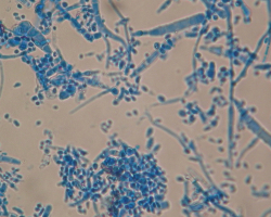 Trichophyton rubrum Abb. 4 b
