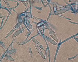 Nannizzia (N.) praecox Abb. 4 a