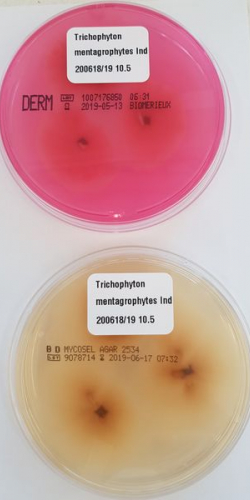 Trichophyton indotineae Abb. 3 f