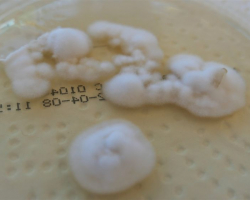 Arthroderma crocatum Abb. 2 a