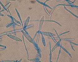 Nannizzia (N.) praecox Abb. 4 b