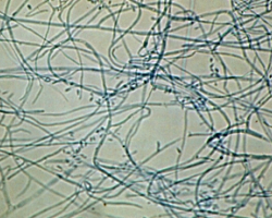 Trichophyton rubrum Abb. 4 a