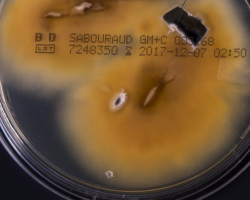 Trichophyton indotineae Abb. 3 b