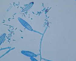 Nannizzia (N.) incurvata Abb. 3 c