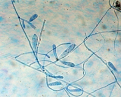 Epidermophyton floccosum Abb. 4