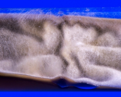 Trichophyton rubrum  Abb. 1