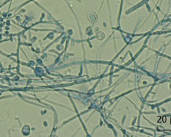 Arthroderma ciferrii Abb. 3 a