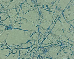 Arthroderma onychocola Abb. 3 a