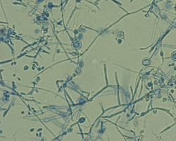 Arthroderma ciferrii Abb. 3 b