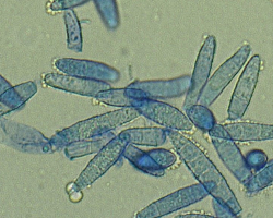 Nannizzia (N.) incurvata Abb. 3 b