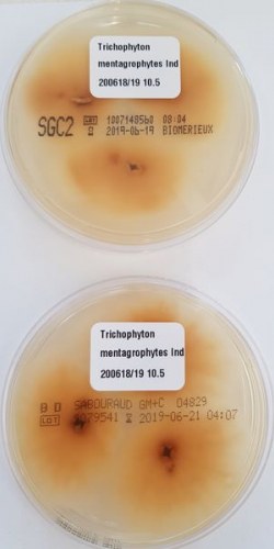 Trichophyton indotineae Abb. 3 d